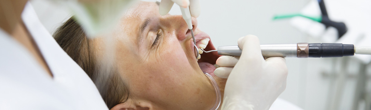 Dominion Street Dental in Alliston, ON offers Periodontal Open Flap Debridement