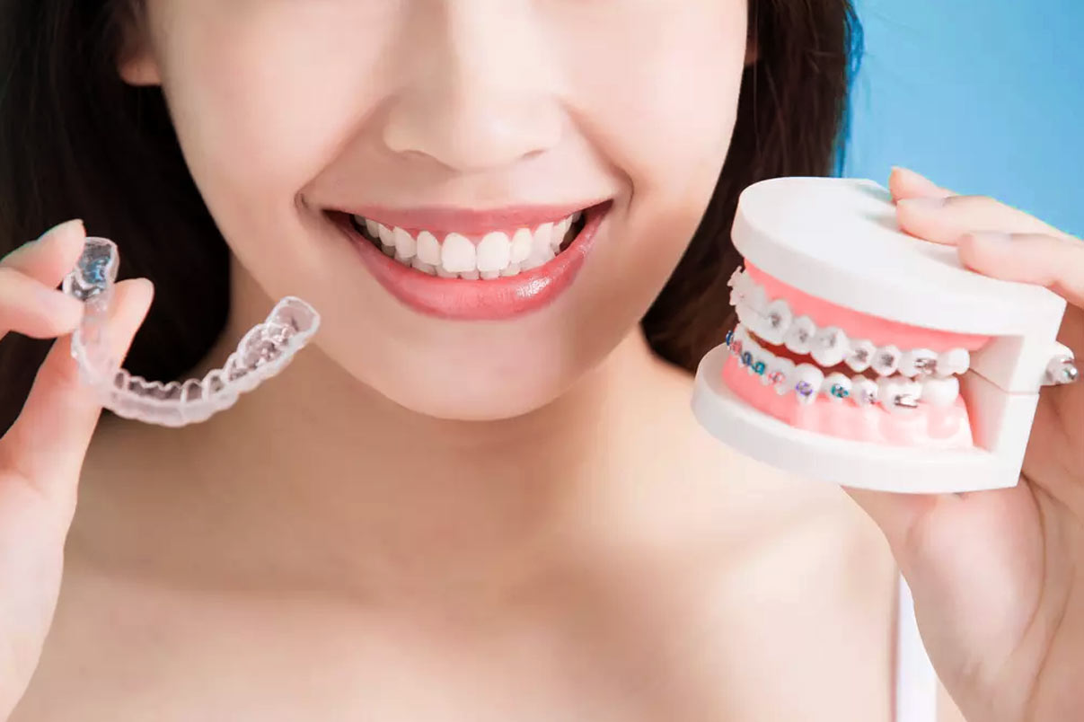 Orthodontic treatment